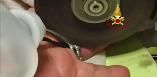Anello bloccato al dito, devono intervenire i Vigili del Fuoco